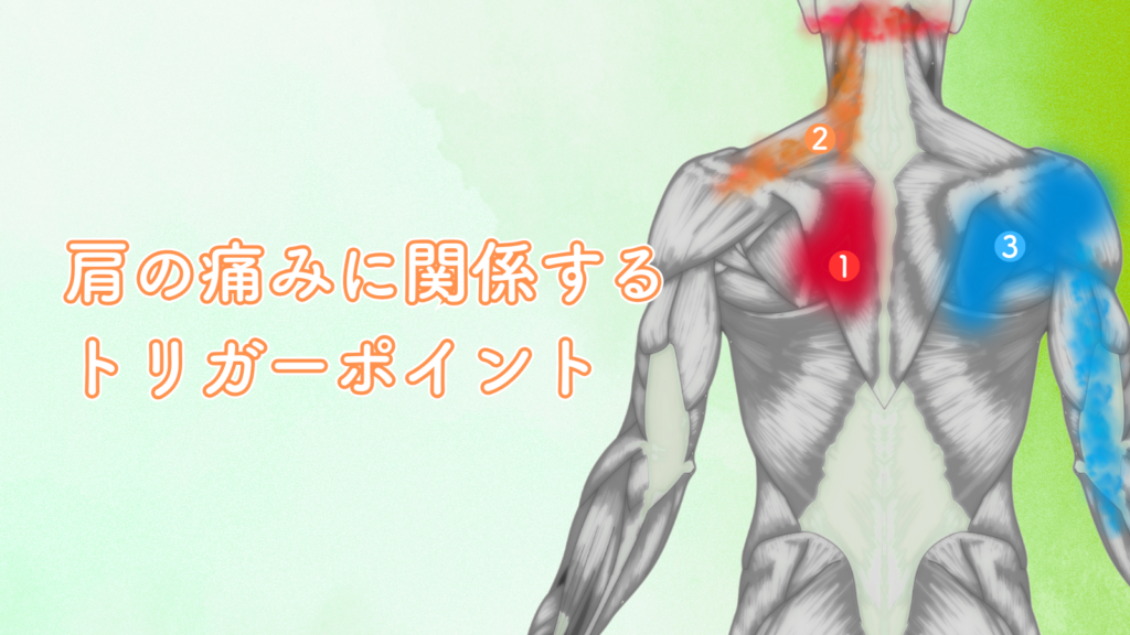 肩の痛みにかかわるトリガーポイント